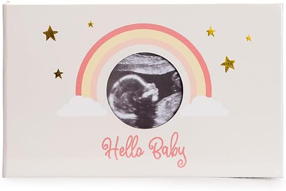 MBHB Ultrasound & Pregnancy Photo Album, 4x6" Picture Album Holds 100 Baby Memories, Perfect Keepsake Scrapbook, Durable Large Design Pictures, Ideal Baby Albums Scrap Book for Photos, Tangerine