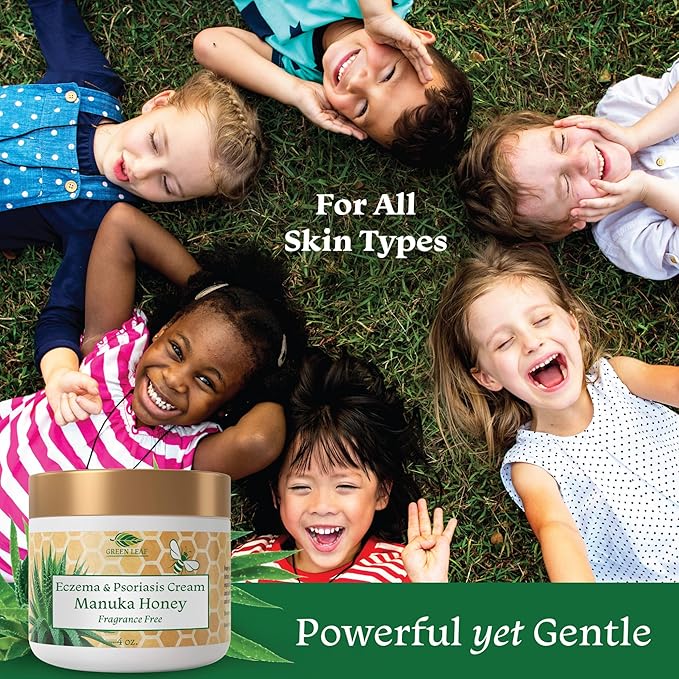 Manuka Honey Eczema Cream Moisturizing Lotion Fragrance Free For Psoriasis Relief - Itchy, Dry Skin Rash Ointment - Skin Soothing Moisturizer - Body & Face Cream - Kids & Adults 16oz