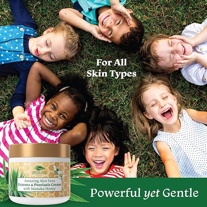 Manuka Honey Eczema Cream Moisturizing Lotion For Psoriasis Relief - Itchy, Dry Skin Rash Ointment -Skin Soothing Moisturizer Baby Kids & Adults-High Strength Body & Face Cream 16oz