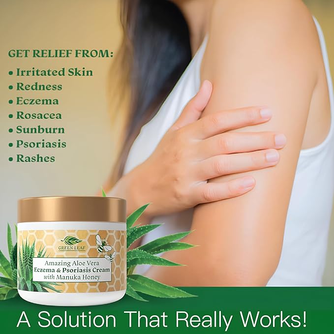 Manuka Honey Eczema Cream Moisturizing Lotion Treatment For Psoriasis Relief - Itchy, Dry Skin Rash Ointment -Skin Soothing Moisturizer Baby Kids & Adults -High Strength Body & Face Cream 8oz